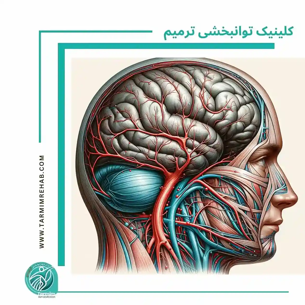  درمان سردردهای میگرنی و شبه میگرنی با فیزیوتراپی