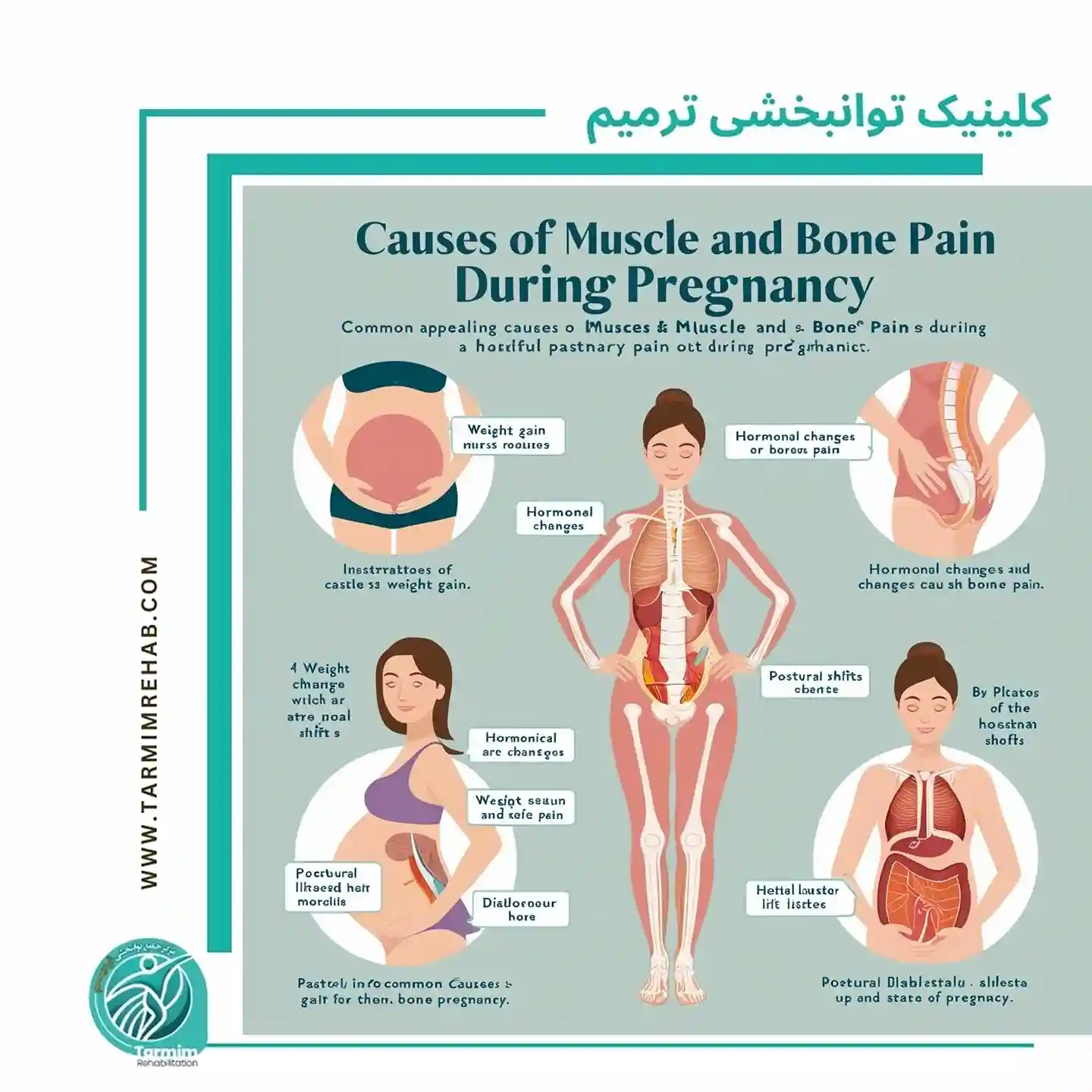 علل دردهای عضلانی و استخوانی در بارداری و تغییرات هورمونی