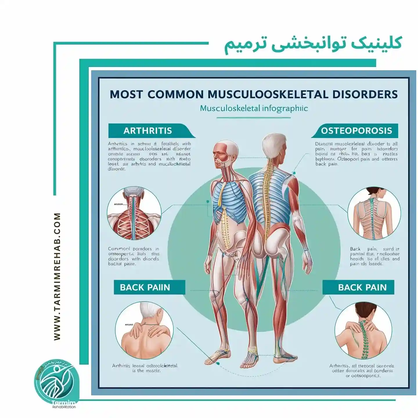 شایع ترین اختلالات اسکلتی عضلانی