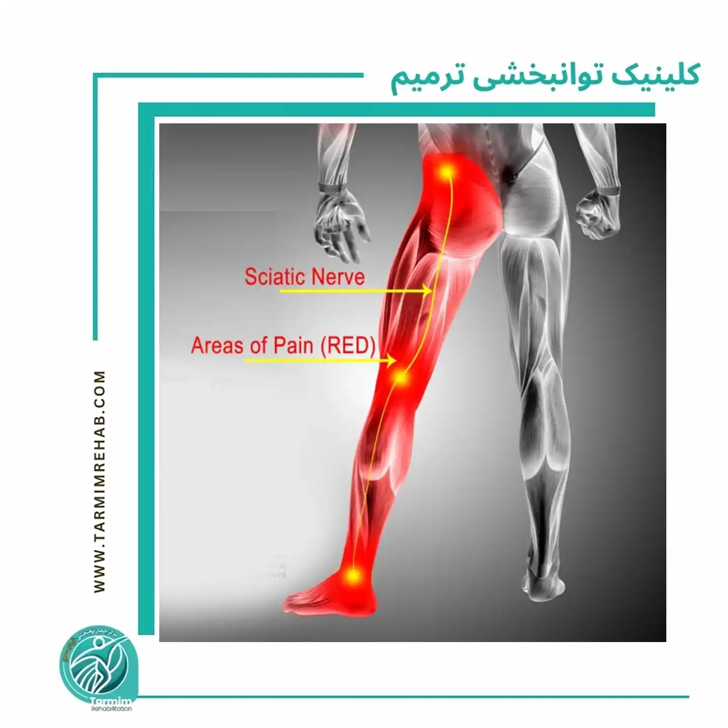 صحیح نشستن و خوابیدن برای دیسک کمر