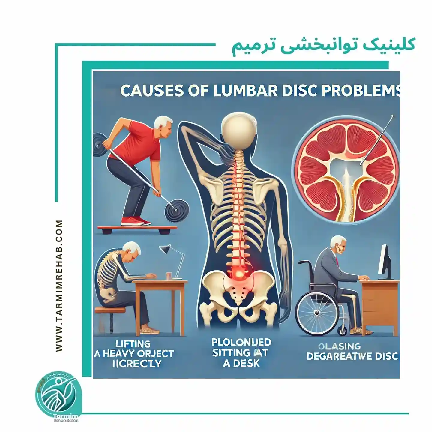 "دلایل ایجاد مشکل در دیسک کمر"