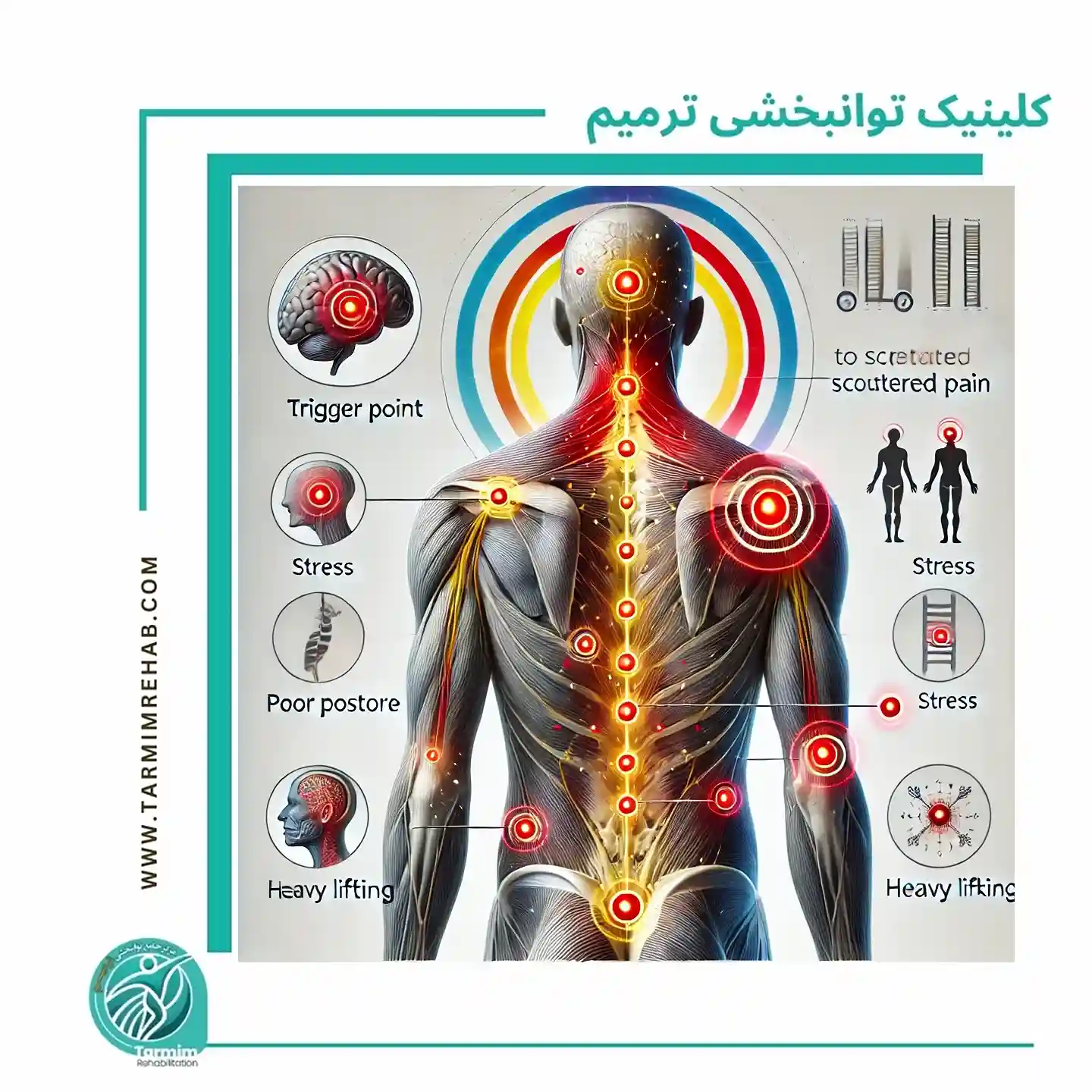  شدت درد ناشی از نقاط ماشه‌ای و ارتباط اون با علت دردهای پراکنده در بدن