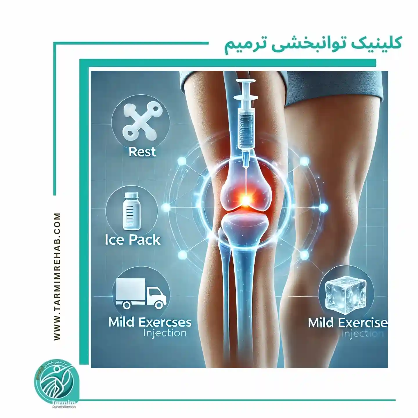 پی آر پی زانو: روش نوین برای درمان زانو