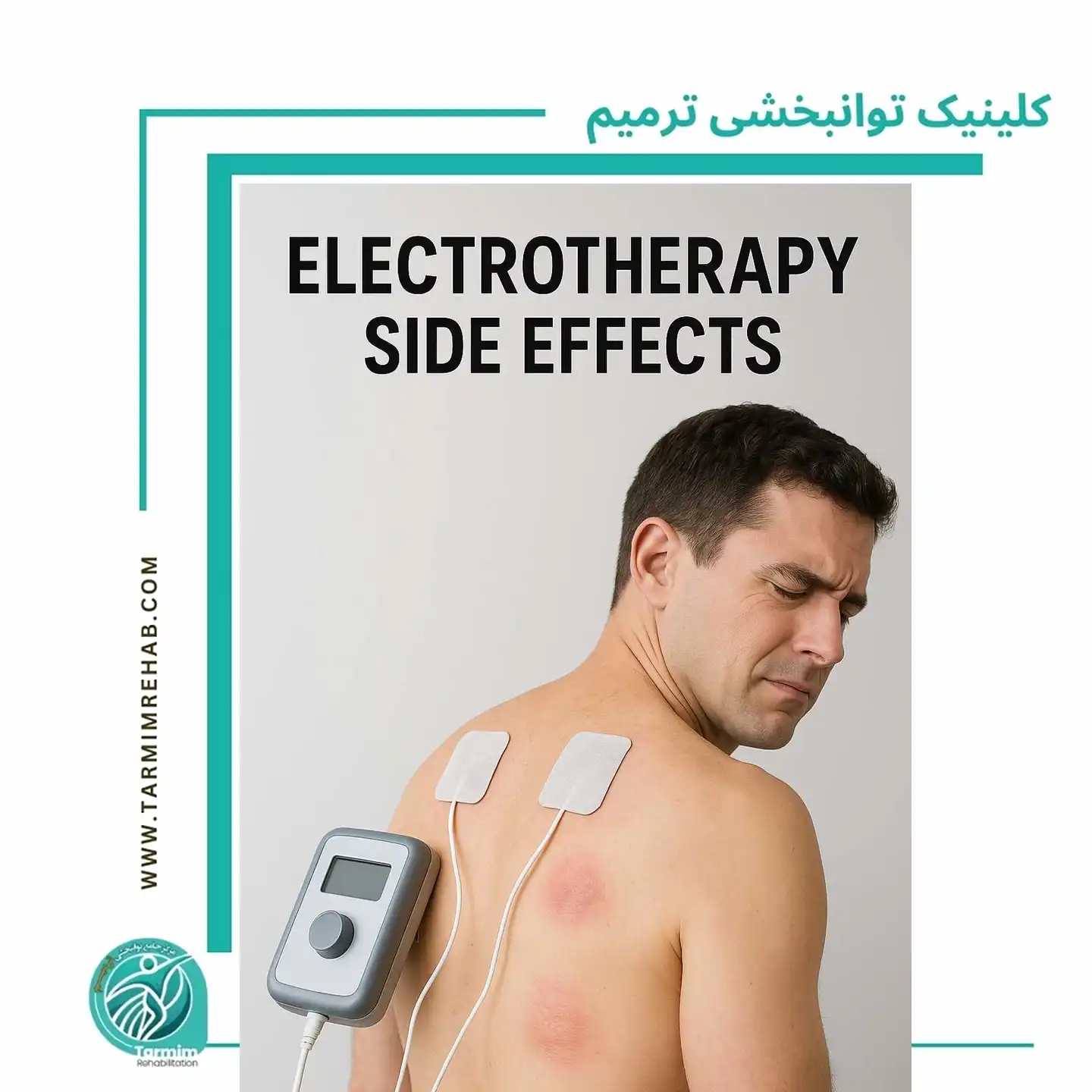 عوارض الکتروتراپی