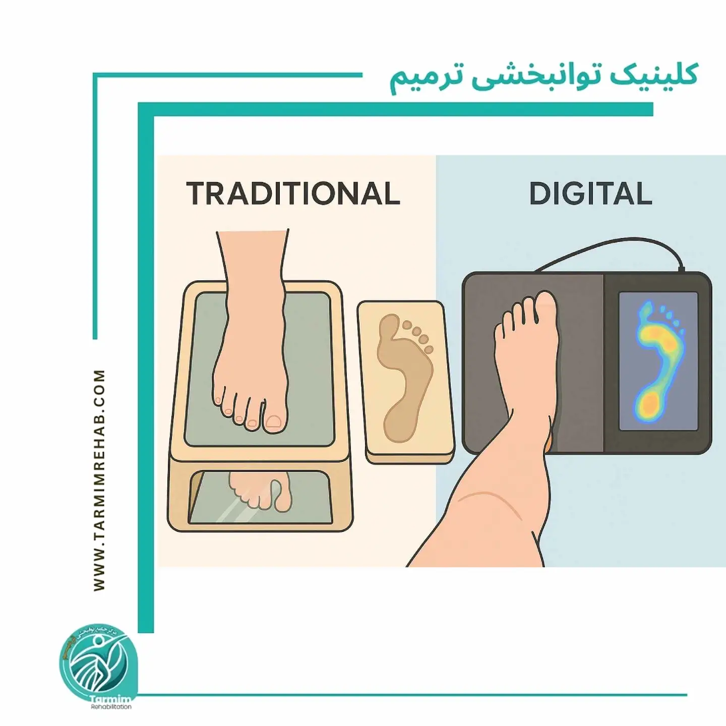 تفاوت اسکن دیجیتال کف پا با روش‌های قدیمی + کدام دقیق‌تر است؟