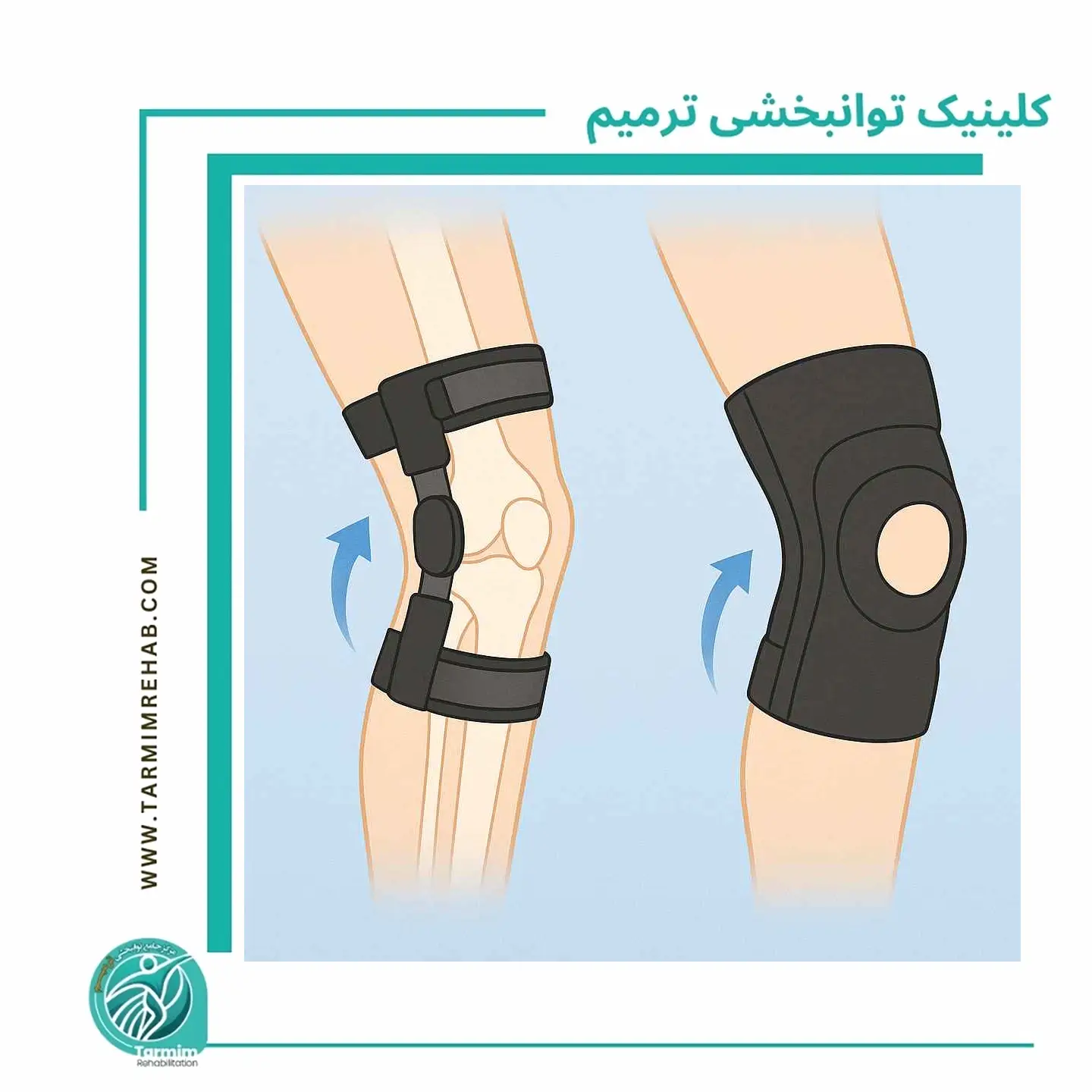 تفاوت بریس اصلاحی و بریس حمایتی + انتخاب مناسب بر اساس مشکل زانو