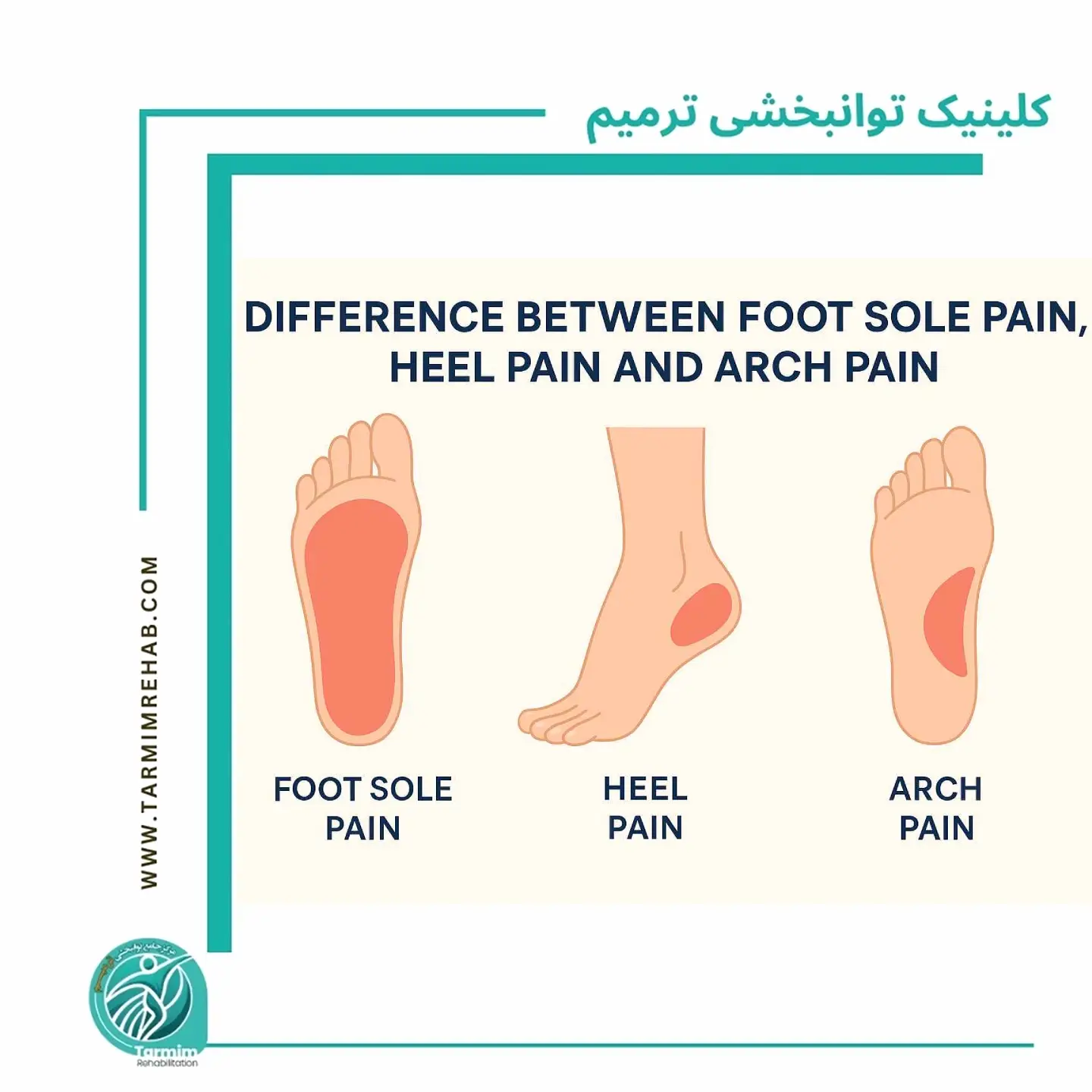 تفاوت درد کف پا، پاشنه و قوس پا + تشخیص خانگی اولیه