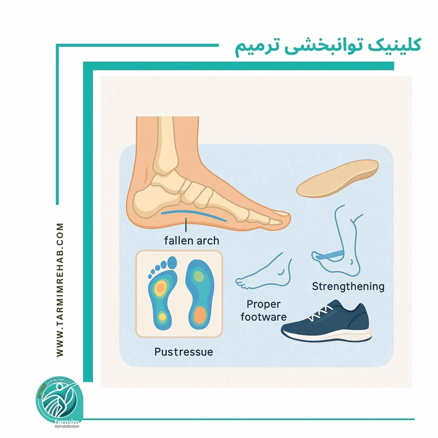 بهترین روش‌های درمان صافی کف پا بدون جراحی