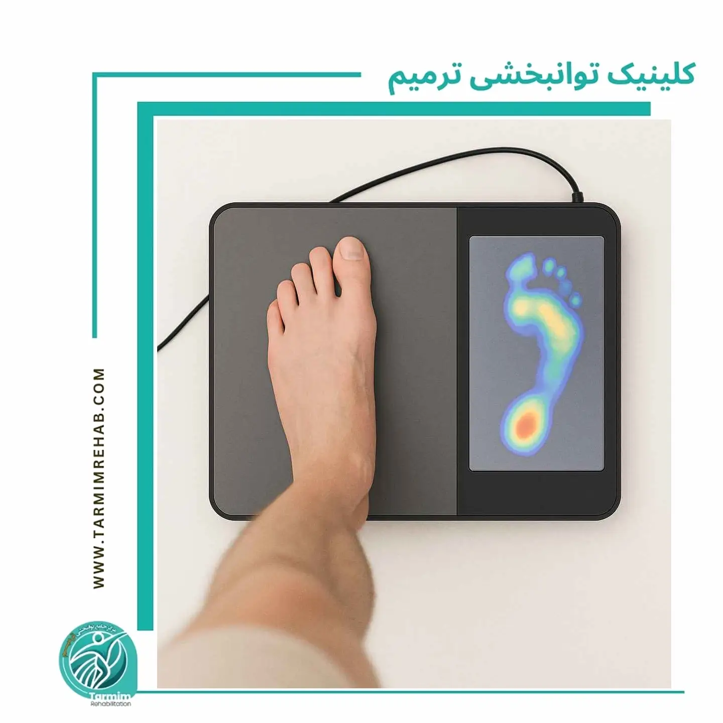 اسکن کف پا چیست و چه مشکلات پنهانی را مشخص می‌کند؟