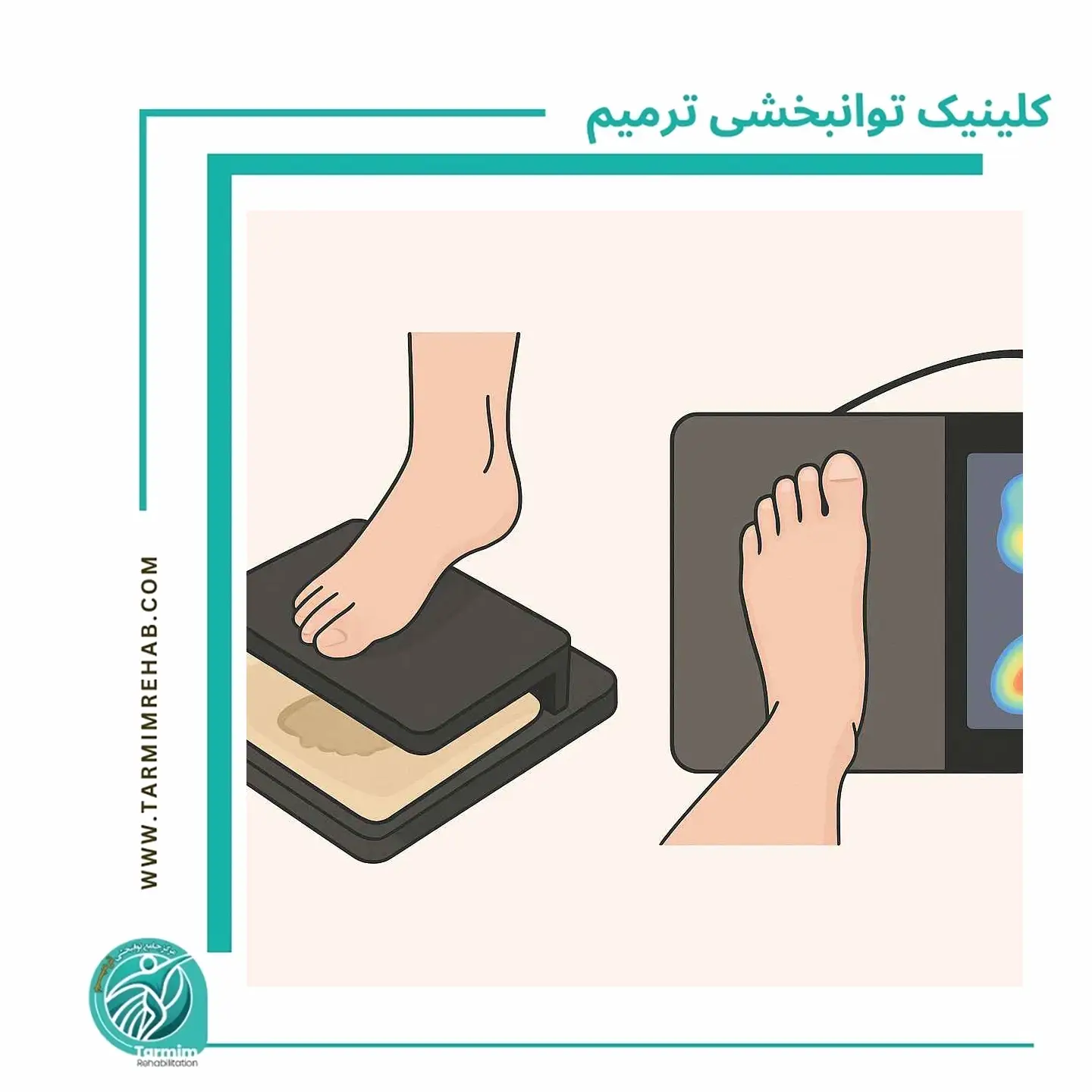 مقایسه روش‌های قدیمی اسکن کف پا مثل پدوسکوپ و قالب‌گیری با اسکن دیجیتال سه‌بعدی