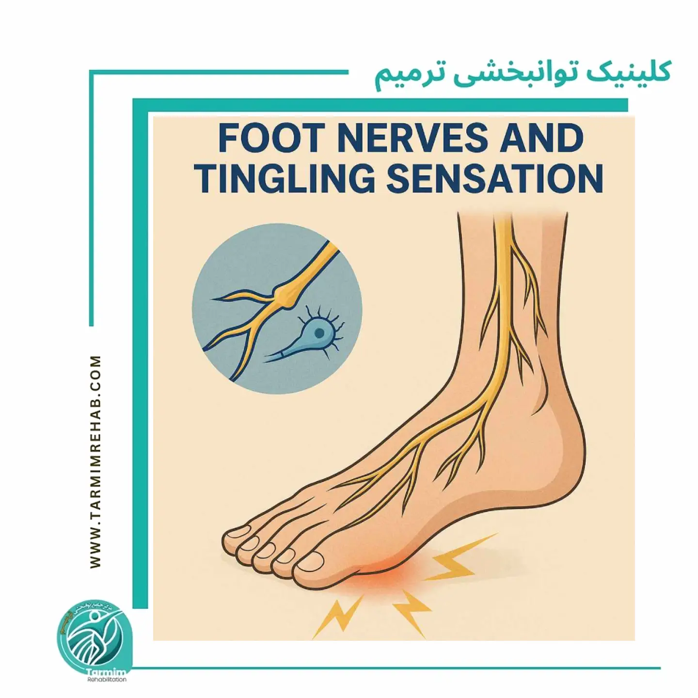 اختلال پیام عصبی و نقش اعصاب در بی‌حسی و گزگز پا