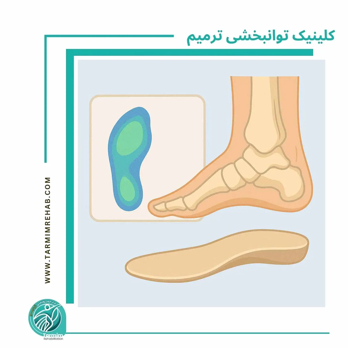 اسکن دیجیتال کف پا و نمونه کفی طبی اختصاصی برای اصلاح فشار و حمایت از قوس
